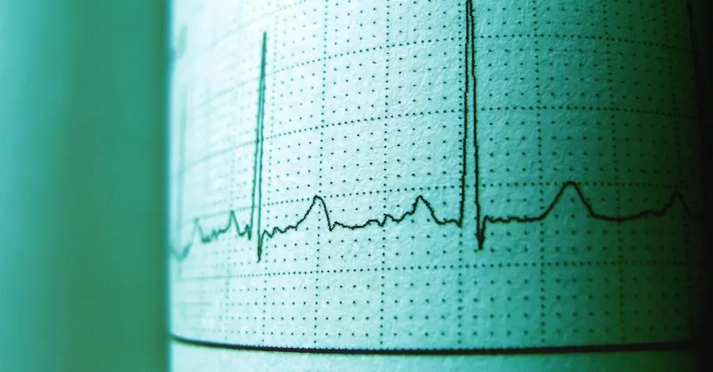 Close-up of an ECG printout displaying heartbeat rhythm and frequency for medical analysis.