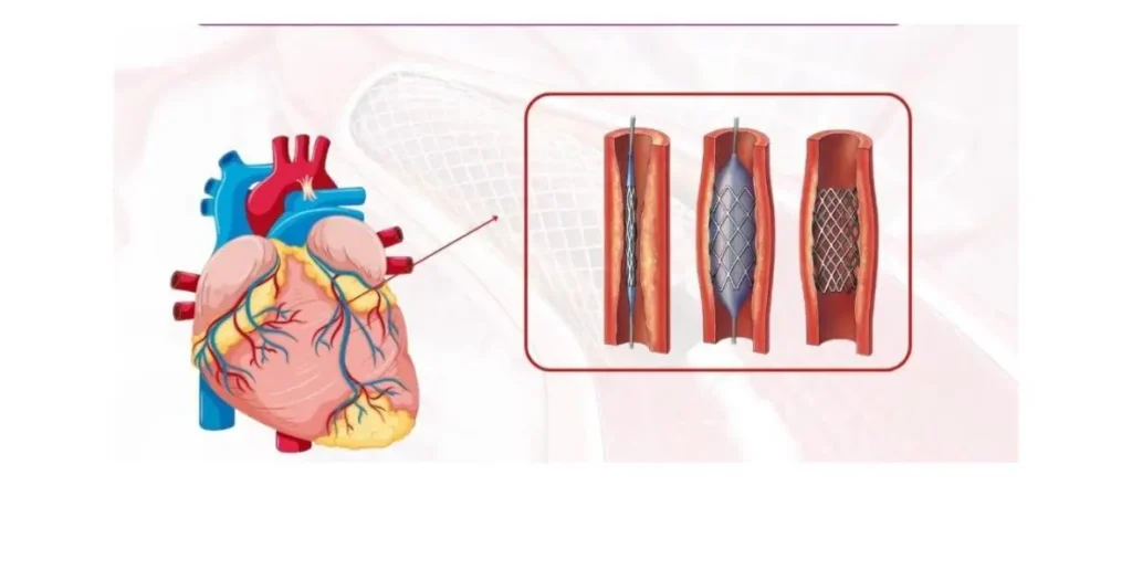 Cardiology Care at Dr Vaggar Clinic